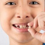 اهمیت حفظ دندانهای شیری تا زمان لقی و افتادن طبیعی آنها