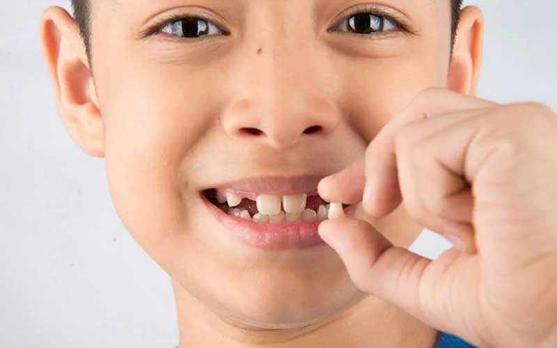 اهمیت حفظ دندانهای شیری تا زمان لقی و افتادن طبیعی آنها