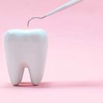 ترمیم دندانهای شیری با روکش‌های استیل ضد زنگ (S.S.crown)